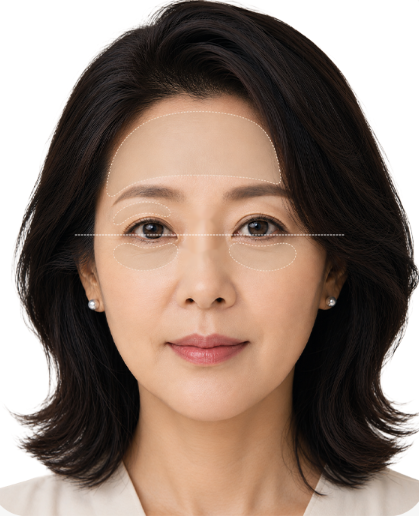 Areas treated in eye rejuvenation surgery